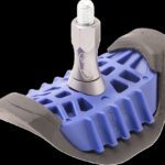 bloque pneu gripster motion pro 1.60